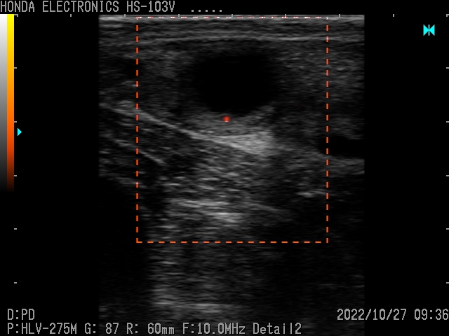 Ovarian Follicle