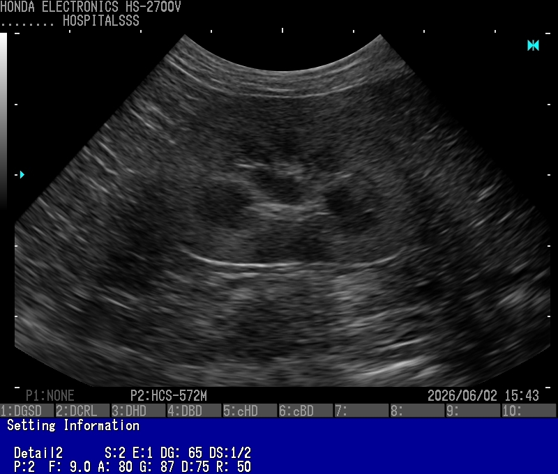 11Kidney(Cat)