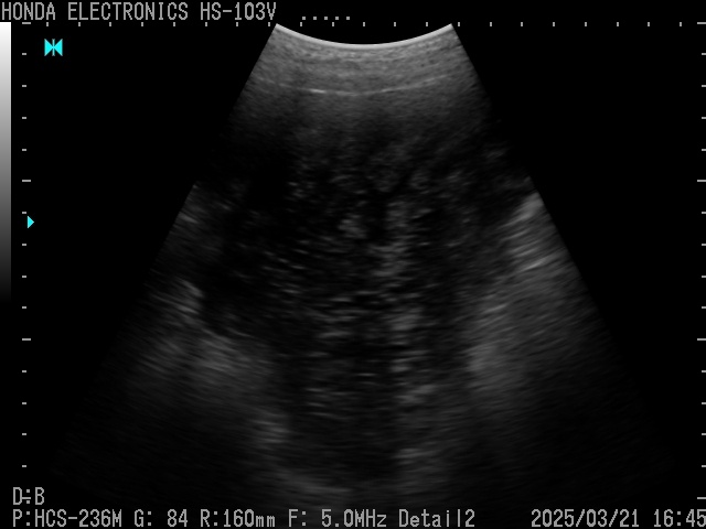 Day 18 of pregnancy (sow)