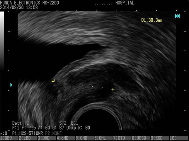 Bladder, prostate (longitudinal section)