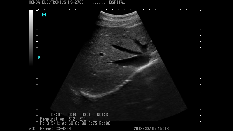 Ultrasound Electronics