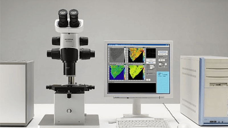 Bio-ultrasonic microscope